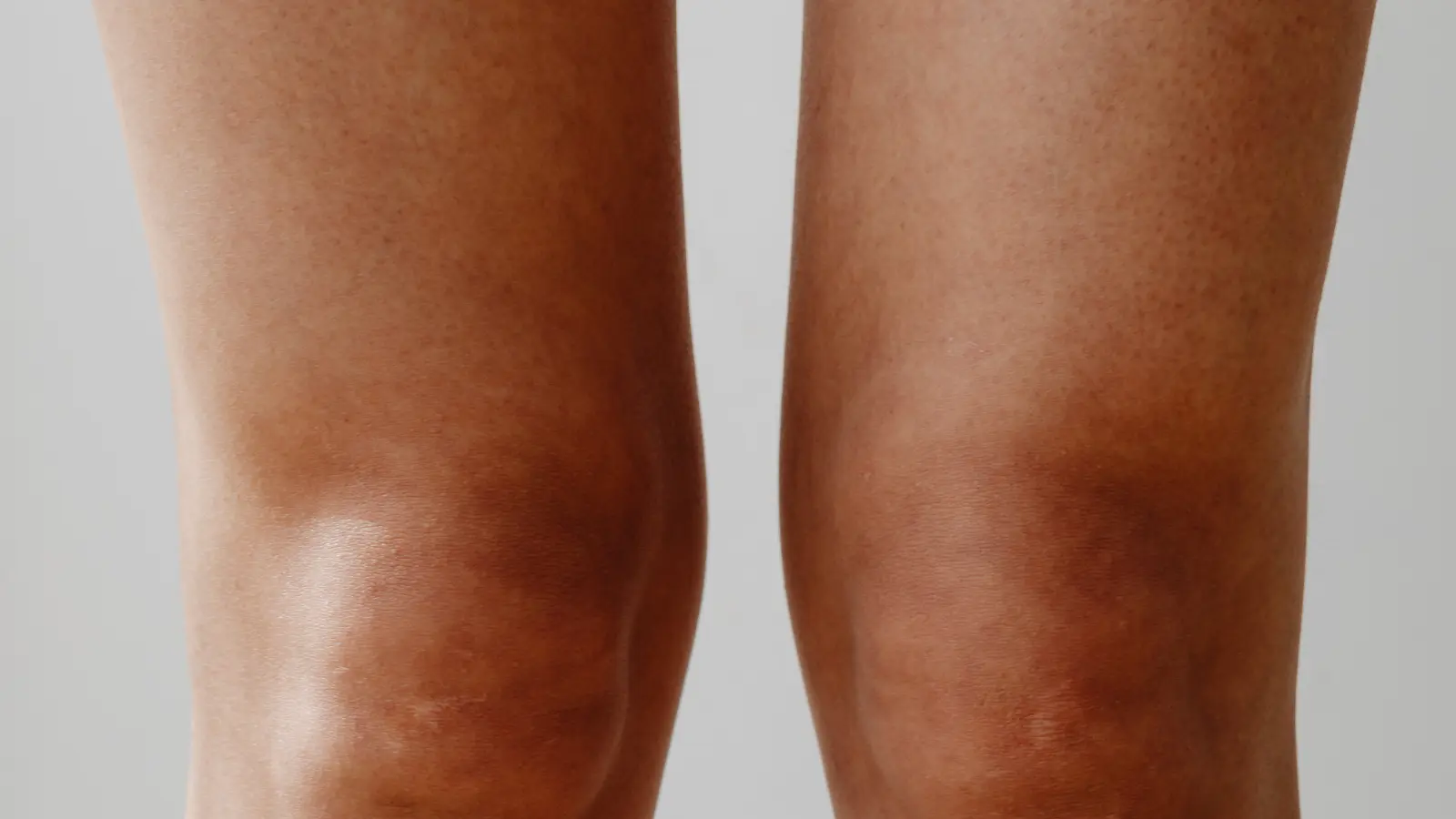 Leg Puns